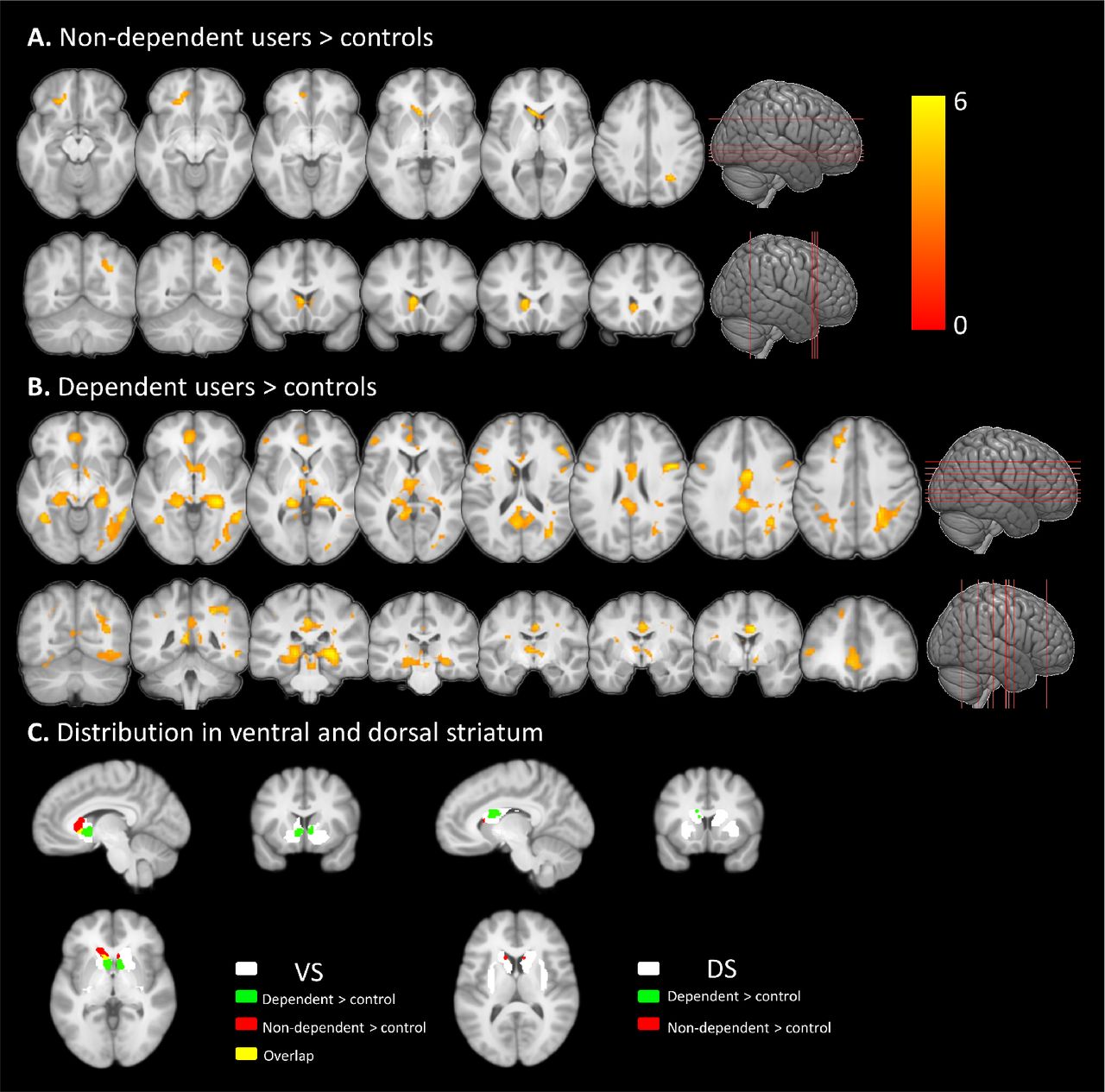 Whole brain cue-reactivity networks in (A) non-dependent, and (B) dependent cannabis users relative to controls. Cue-reactive regions were determined using the contrast [cannabis cues > neutral cues], activation color bars for both groups (displayed in A, B) were scaled to the same range. (C) The activity distribution from (A) and (B) located in ventral and dorsal striatum mask separately. Results displayed at whole-brain cluster level pFWE < 0.05.