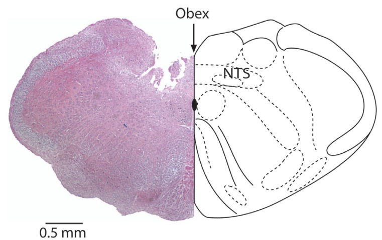 Coronary section of the medulla oblogata at the level of obex showing the microinjection site in the NTS. Calibration bar is 0.5 mm.