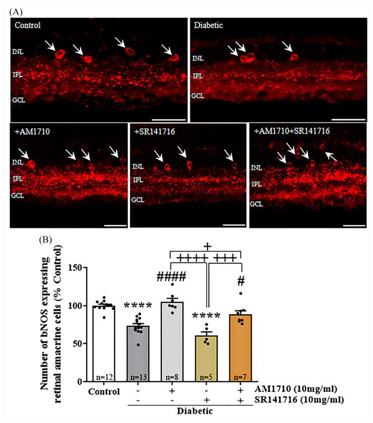 Effect of cannabinoid treatment on the nitric oxide synthetase (bNOS) expressing retinal amacrine cell viability in the diabetic retina. (A) Representative photomicrographs of bNOS immunoreactivity (bNOS-IR). White arrows indicate bNOS expressing retinal amacrine cells. Magnification: 40×. Scale bar: 50 μm. (B) Quantification of bNOS-IR: Diabetes attenuated in a statistically significant manner the number of bNOS expressing retinal amacrine cells, compared to Control animals (**** p < 0.0001 compared to Control). AM1710 reversed the diabetes effect (#### p < 0.0001 compared to diabetic untreated, p > 0.05 compared to Control). SR141716 had no effect (p > 0.05 compared to diabetic untreated, **** p < 0.0001 compared to Control, ++++ p < 0.0001 compared to AM1710). The dual treatment, AM1710+ SR141716, blocked diabetes-induced loss of bNOS+ cells (# p = 0.0192 compared to diabetic untreated, + p = 0.0388 compared to AM1710, +++ p = 0.0003 compared to SR141716). Data are expressed as mean ± S.D and presented in a form that combines a bar diagram and scatter dot plot, with every dot representing a different value. One-way ANOVA was employed for the statistical analysis of all data, followed by Tukey’s multiple comparison test. Differences were considered statistically significant when p < 0.05.