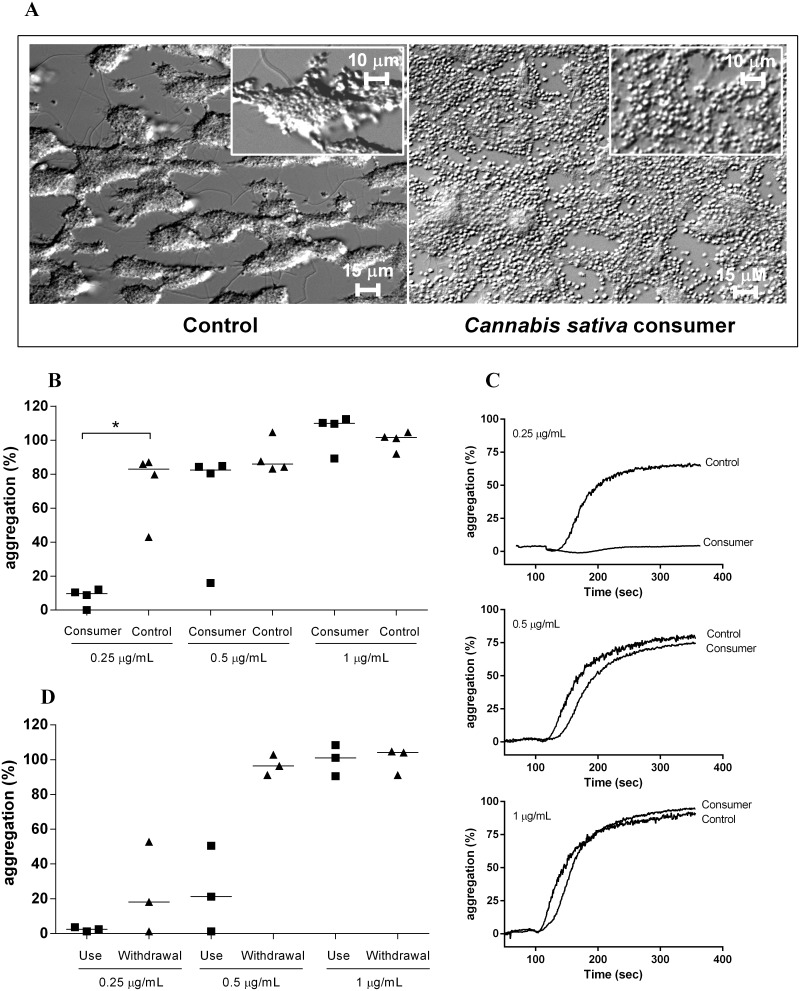 Cannabis sativa consumption limits platelet aggregate formation under flow and reduces platelet responsiveness to collagen.Whole blood from Cannabis sativa consumers (n = 4; “Consumers”) or healthy control donors (“Controls”) was perfused for 5 minutes over immobilized collagen at a shear rate of 1600 s−1 (A). In further experiments, collagen-induced platelet aggregation was investigated in platelet-rich plasma from these Cannabis sativa consumers and controls (B). Representative aggregation curves are shown in panel C. Finally, collagen-induced platelet aggregation was studied in platelet-rich plasma of three self-reported Cannabis sativa consumers on two separate instances: once after 10 days of daily consumption of Cannabis sativa (“Use”), as well as after a period of 10 days without consumption (“Withdrawal”).