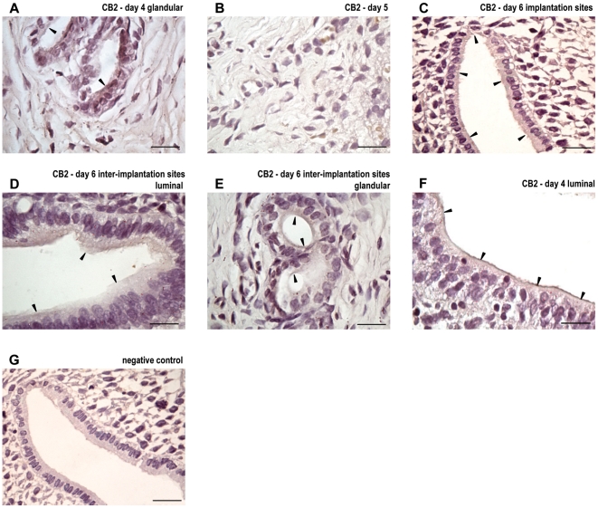 Localization of cannabinoid receptor type 2 during implantation.Immunolocalization of cannabinoid receptor and type-2 (CB2) in uteri from day 4 (A: luminal and B: glandular), day 5 (C), day 6 implantation sites (D) and day 6 inter-implantation sites (E: luminal, F: glandular). Tissue sections were processed by the immunoperoxidase technique using a polyclonal antibody directed against CB2. No staining was observed in the luminal and glandular epithelium when the first antibody was omitted (G). Black arrows denote specific staining. The scale bar indicates 20 µm.