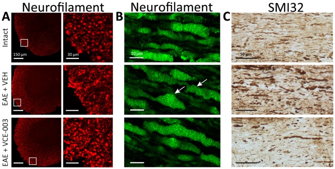 VCE-003 reduces axon damage.Representative images of axon morphology changes: (A) transversal thoracic spinal cord sections, neurofilament staining in red; (B) longitudinal thoracic spinal cord sections, neurofilament staining in green (please note axon swelling, arrows). (C) VCE-003 treatment helps to preserve the axon structure as showed in longitudinal thoracic spinal cord sections by SMI32 staining.