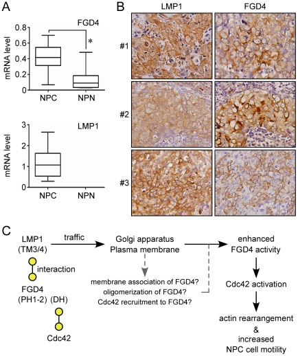 Expressions of LMP1 and FGD4 in NPC tissues.(A) Elevated FGD4 mRNA levels in NPC specimens compared with normal nasopharyngeal tissues. mRNA was isolated from specimens of 13 NPC patients (NPC) and 14 control individuals with nasosinusitis (NPN). Each mRNA sample was then reverse transcribed and analyzed by quantitative RT-PCR using specific primer sets. The expression levels of FGD4 or LMP1 in each specimen were determined by normalizing the reading of FGD4 or LMP1 to that of COL4A6 (Collagen, type IV, alpha), an internal control that showed a consistent expression level among specimens. The data were analyzed by Box-plot analyses. The box indicates the 25th and 75th percentiles of the data range; the middle line indicates the median (*P = 0.0005; two-tailed Mann Whitney test). (B) Immunohistochemical staining for LMP1 and FGD4 in formalin-fixed, paraffin-embedded consecutive NPC tissue sections. Predominant expression of LMP1 and FGD4 was detected at the cell membrane. The images shown are representative from three cases and were acquired at 400× magnification. (C) Model for the action of the LMP1-FGD4-Cdc42 axis in NPC cells. The viral oncoprotein LMP1 interacts with FGD4, a Cdc42 GEF, mainly through the transmembrane domains 3 and 4 (TM3/4) of LMP1 and the PH1-to-PH2 domains (PH1-2) of FGD4. During the intracellular trafficking of LMP1 to the lipid-rich compartments (the Golgi apparatus and the plasma membrane), LMP1 interaction with FGD4 may promote membrane association, oligomerization, and/or conformation change of FGD4, leading to an enhanced FGD4 activity toward Cdc42. The LMP1-involved membrane association of FGD4 may also increase the chance for FGD4 to recruit Cdc42 (via the FGD4 DH domain) that is targeted to the membrane by independent mechanisms, thereby inducing Cdc42 activation. Once activated, active Cdc42 subsequently binds downstream effectors that are involved in regulating the arrangement of actin filament, ultimately contributing to increased cell motility of NPC cells.