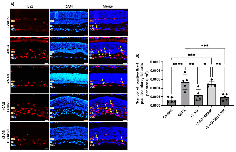 Effect of 2-AG on AMPA-induced microglial cell activation. (A) Representative images of Iba-1 (red) and DAPI (blue) IHC staining showing positive microglial cells in retinas of control rats and rats treated with AMPA (8.4 mM, I.V.T.), AMPA + 2-AG (50 μg/kg, i.p.), AMPA + 2-AG + AM630 (500 μg/kg, i.p.) or AMPA + 2-AG + SR141716 (500 μg/kg, i.p.). Reactive microglial cells are depicted by the yellow arrows. Magnification: ×20. Scale bar: 50 μm. (B) Quantitative analysis of reactive Iba-1+ microglial cells. Data are expressed as the mean ± SD (n = 5); * p < 0.05, ** p < 0.01, *** p < 0.001, ****p < 0.0001.
