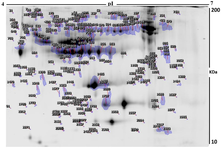 Fluorescence labeled (CyDyes)-2D-DIGE numbered spots indicate those proteins that were identified to be differentially abundant (defined as fold-change >1.5, p < 0.05) between the two groups (controls and CUD). These were successfully identified with matrix-assisted laser desorption/ionization time of flight (MALDI-TOF) mass spectrometry (MS). MW, protein molecular weight; pI, isoelectric point.