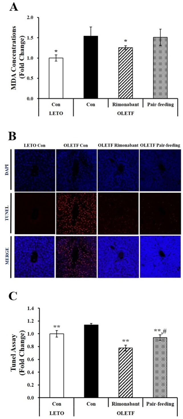Cell apoptosis in the livers of OLETF rats administered either PBS or rimonabant for 6 weeks.(A) MDA concentrations were normalized to their respective protein concentrations and expressed as fold change compared to LETO control group (LETO Con). (B) TUNEL-positive apoptotic hepatocytes showing red under a confocal microscope (scale bars, 50 μm; magnification, 800 X). (C) Semi-quantification of TUNEL-positive cells from four randomly selected fields were normalized to LETO rats (LETO Con). Results are represented as mean ± SEM (n = 4–5 per group). *P < 0.05, **P < 0.01 compared to OLETF control rats (OLETF con). #P < 0.05 compared to rimonabant-treated OLETF rats (OLETF rimonabant).