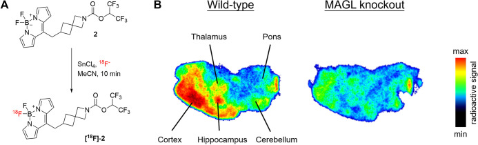 (A) Synthetic conversion of probe 2 into a bimodal fluorescent positron emission tomography (PET) probe [18F]-2. (B) In vitro autoradiography of wild-type and MAGL knockout mouse brain sections with [18F]-2 (45 nM, 8 GBq/μmol).