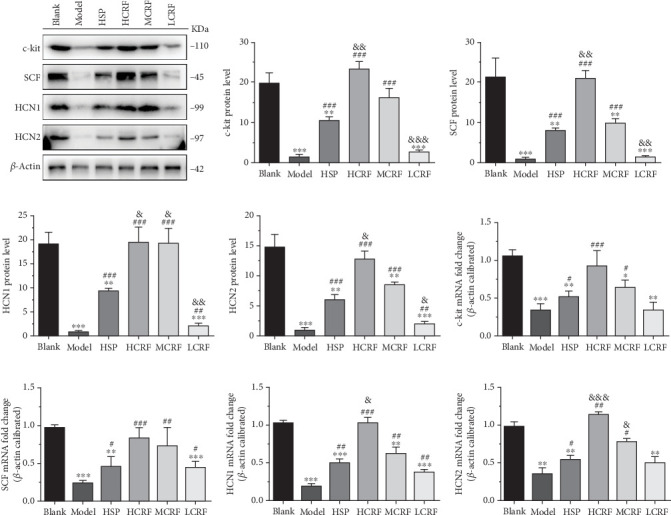 The expressions of c-kit, SCF, HCN1, and HCN2 mRNA and protein in the ascending colon of rats. (a) The protein levels of c-kit, SCF, HCN1, and HCN2 in the ascending colon of FC rats were detected by Western blotting. The relative quantitative histogram of (b) c-kit, (c) SCF, (d) HCN1, and (e) HCN2 protein levels in the ascending colon of FC rats. The mRNA levels of (f) c-kit, (j) SCF, (h) HCN1, and (i) HCN2 in the ascending colon of rats were detected by RT-PCR. HSP: hemp seed pill group; HCRF: high-dose CRF group; MCRF: medium-dose CRF group; LCRF: low-dose CRF group. ⁣∗p < 0.05, ⁣∗∗p < 0.01, ⁣∗∗∗p < 0.001 vs. blank; #p < 0.05, ##p < 0.01, ###p < 0.001 vs. model; and &p < 0.05, &&p < 0.01, &&&p < 0.001 vs. HSP.