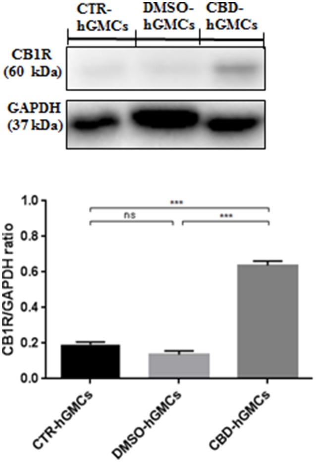 Western blot analysis for CB1R. CB1R expression is increased in CBD-hGMSCs compared to control groups (DMSO-hGMSCs and CTR-hGMSCs). ***p < 0.001. ns, no statistical differences.