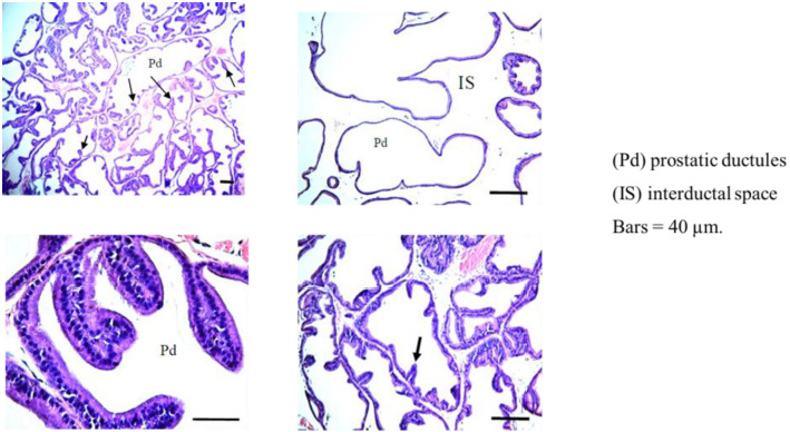Metabolic syndrome-induced histopathological changes in rat prostate tissues. Images were taken from the same group of rats and in some cases from the same animal, but at different magnifications to show the changes in epithelial heights (indicated by arrows).