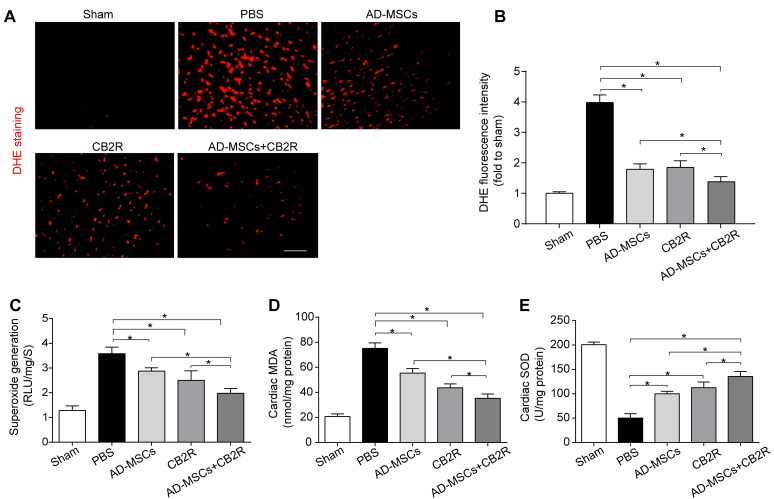 CB2 agonist adjuvant with AD-MSCs leads to attenuation of myocardial oxidative stressA., B. Representative images of dihydroethidium fluorescence staining that evaluated ROS generation in myocardium and bar graph summarizing fluorescence intensity on POD3(n = 5). bar = 100μm; C. Myocardial levels of O2- by lucigenin chemiluminescence method on POD3 (n = 5). D. Cardiac levels of MDA by enzyme-linked immunosorbent assay (ELISA) on POD3 (n = 5). E. Myocardial levels of SOD by testing kits. *P < 0.05 between indicated groups.