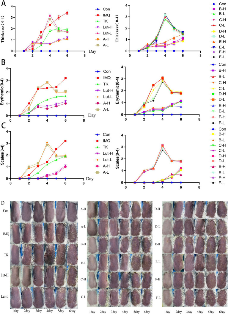 (A), (B) and (C): The PASI score for the back skin of mice, (D): Changes in the back skin of a mice psoriasis injury model induced by imiquimod.