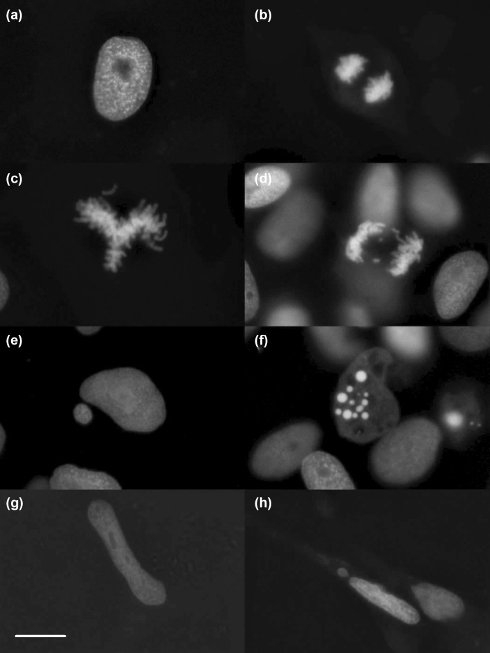 Nuclear structure of fixed cells with nuclei in interphase (a), during anaphase (b), during metaphase with difficulties to align properly (c), during anaphase with lagging chromosomes (d), as a main nucleus with a micronucleus beside (e), as a fragmented nucleus (f), as an elongated nucleus (g) and as a motile, elongated nucleus with a micronucleus beside (h). Pictures were taken in unexposed cultures (a, b), in colchicine exposed cultures (c, d), in 4-NQO exposed cultures (e, f) and in cannabidiol exposed cultures (g, h). Scale bar: 10 µm