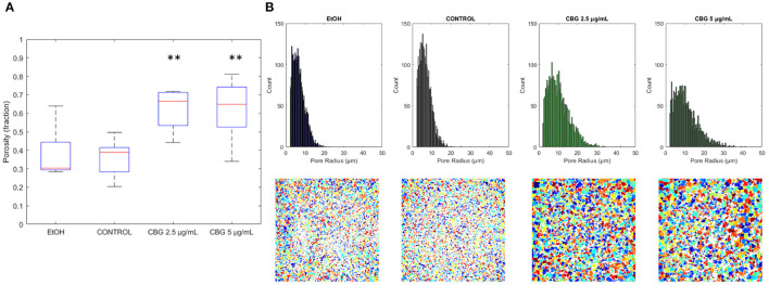 Central layer porosity. (A) Boxplot of porosity values at the central layer. **p < 0.01. (B) Pore size distribution is shown in the top row, with representative images of pore spaces at central layers of each category shown in the bottom row.