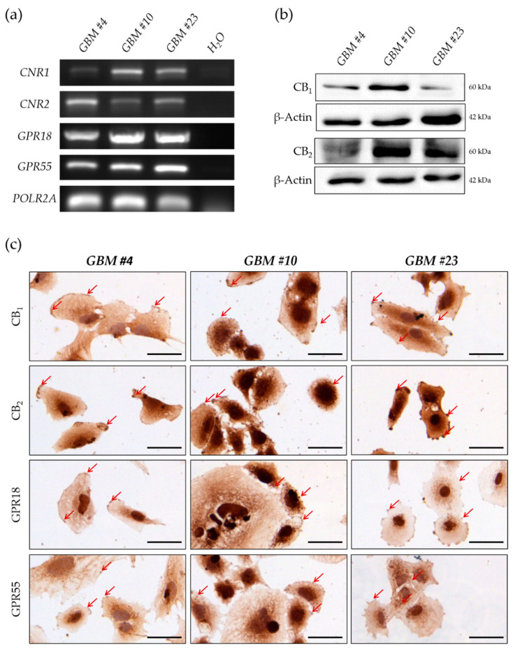 Characterization of human GBM cells regarding their expression of classical and orphan cannabinoid receptors. (a) mRNA for human CB1 (CNR1), CB2 (CNR2), GPR18 (GPR18), and GPR55 (GPR55) receptors were present in all GBM cells. RNA polymerase II subunit A (POLR2A) was used as a housekeeping gene. (b) Western blot analysis revealed the expression of all receptors on protein level. β-Actin was used as loading control. (c) Immunochemical staining showing the presence of CB1, CB2, GPR18, and GPR55 on the cell surface of GBM #4, GBM #10, and GBM #23 (red arrows). Nuclei were counterstained using hematoxylin. Scale bar = 50 µm.