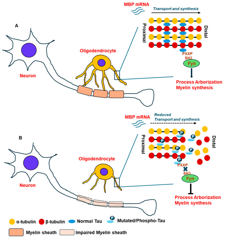 Function of tau in axonal transport and myelin sheath formation by oligodendrocytes in normal and tauopathy brains: (A) The diagram shows the integral function of tau in assembling the tubulins of the microtubule machinery and in interacting with the FYN kinase that promotes axonal transport of mRNA myelin basic protein (MBP) towards the distal end of the processes and collectively these phenomenon facilitates oligodendrocyte maturation, arborization, formation of myelin sheath over the neuronal axons in normal healthy brain. (B) Presence of mutated and/or abnormally modified tau by post-translational modifications (phosphorylation) causes diminished affinity to bind microtubule structural components and its interaction with the FYN kinase resulting in collapse of the microtubule and reduced transport of important cargos including mRNA of MBP towards the end of the processes. It leads to reduced arborization and myelin synthesis by oligodendrocytes and that causes breakdown of the myelin sheath over the neuronal axons as observed in diseased tauopathy brain.