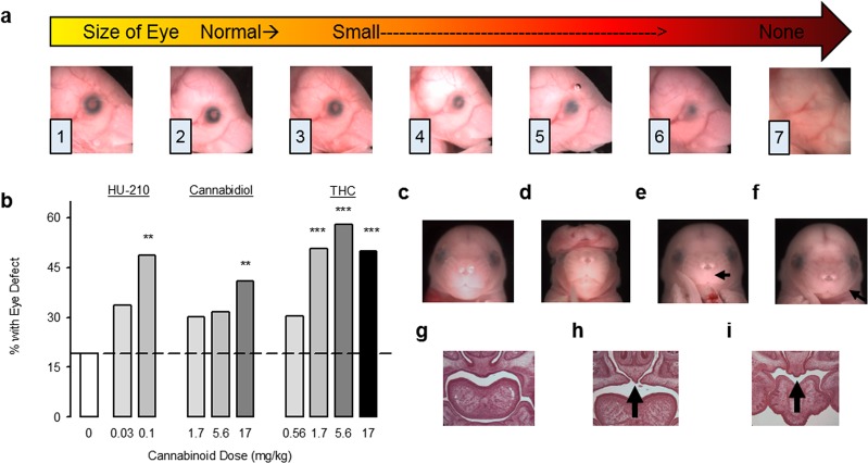 Prenatal cannabinoid exposure causes eye and face malformations in fetal mice. (a) Representative photographs of GD 17 mice that had been exposed to CB treatments on GD 8, with eyes ranked in severity from normal (1) to anophthalmic (7). Minor alterations of pupil shape and size occur in ranks (2) and (3), while colobomas are scored as (4–6). (b) The incidence of defects in either the right or the left eye in fetal mice following GD 8 exposure to the CB vehicle (n = 63 fetuses/8 litters), HU-210 0.03 mg/kg (n = 89 fetuses/11 litters), HU-210 0.1 mg/kg (n = 35 fetuses/6 litters), CBD 1.7 mg/kg (n = 63 fetuses/8 litters), CBD 5.6 mg/kg (n = 60 fetuses/7 litters), CBD 17 mg/kg (n = 78 fetuses/10 litters), THC 0.56 mg/kg (n = 76 fetuses/9 litters), THC 1.7 mg/kg (n = 81 fetuses/11 litters), THC 5.6 mg/kg (n = 69 fetuses/10 litters), THC 17 mg/kg (n = 80 fetuses/10 litters). **p < 0.01, ***p < 0.001, Chi-Square vs. CB vehicle. (c–i) Craniofacial and palate malformations caused by prenatal CBs. (c) A typical face following CB vehicle treatment. (d) An exencephaly caused by HU-210 (0.1 mg/kg, 4 cases). (e) A philtrum deficiency caused by CBD (17 mg/kg, 1 case). (f) micrognathia caused by THC (17 mg/kg, 1 case, also observed after CBD 1.7 and 5.6 mg/kg). (g) Hematoxylin and eosin staining of coronal sections through the anterior palate of a typical CB vehicle-treated fetus. (h,i) Cleft anterior palates caused by THC (h 1.7 mg/kg, i 17 mg/kg), as indicated by the black arrows. Data are expressed as the percent of mice with eye defects (number of affected mice/total number of mice *100), observed in a single experiment. See also Supplementary Table 1 for data on eye defect severity, body weight and length, and the number of live offspring per litter. See Supplementary Fig. 2a,b for separate analysis of left and right eye defects.
