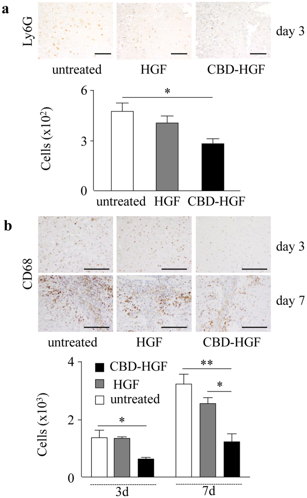 Leukocyte infiltration after spinal cord compression injury. Mice subjected to a compression injury were treated with a single administration of CBD-HGF or HGF. Untreated mice were used as controls (5 mice each per 3 groups). Immunohistochemistry for Ly6G (a) and CD68 (b) at the injury sites was performed 6 weeks post-injury. Upper: Representative photographs from each group. The scale bar indicates 100 µm (a) and 200 µm (b). Lower: The numbers of cells were counted under a microscope. *p < 0.05, **p < 0.01.