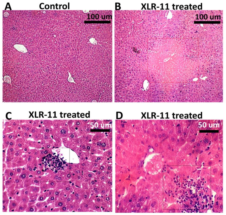 Histopathology of the liver from control mice (A) and XLR-11 treated mice (B–D). Red square box indicates centrilobular necrosis, black square boxes indicate spotty necrosis associated with lymphocytic infiltrate.