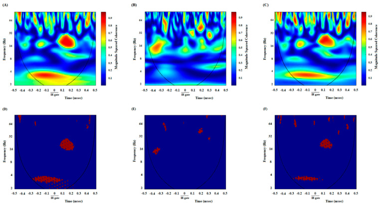 Comparison of coherence of group averages between high remuneration/high endeavor trials in the control group (A), low remuneration/low endeavor trials in the agonist-treated group (B), and high remuneration/high endeavor trials in antagonist-treated animals (C) during endeavor-related decision-making. Time-frequency representation of group averages coherence between the ACC and NAc for n = 53 trials. The cone of influence (COI) where edge effects should be considered is blurred. Notably, the wavelet scales are converted to approximate frequencies on the graphs. Comparison of areas in which the coherence is significantly different compared to a large number of surrogate data between high remuneration/high endeavor trials in the control group (D), low remuneration/low endeavor trials in agonist-treated animals (E), and high remuneration/high endeavor trials in antagonist-treated animals (F). The red regions in the figures show the areas with a significant difference (p < 0.05). Surrogate data were simulated using bootstrapping (n = 1000).