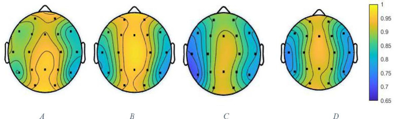 The topographic maps of the determinism parameters in the A: Meth, B: Opioids (Op), C: Can and D: HC groups.