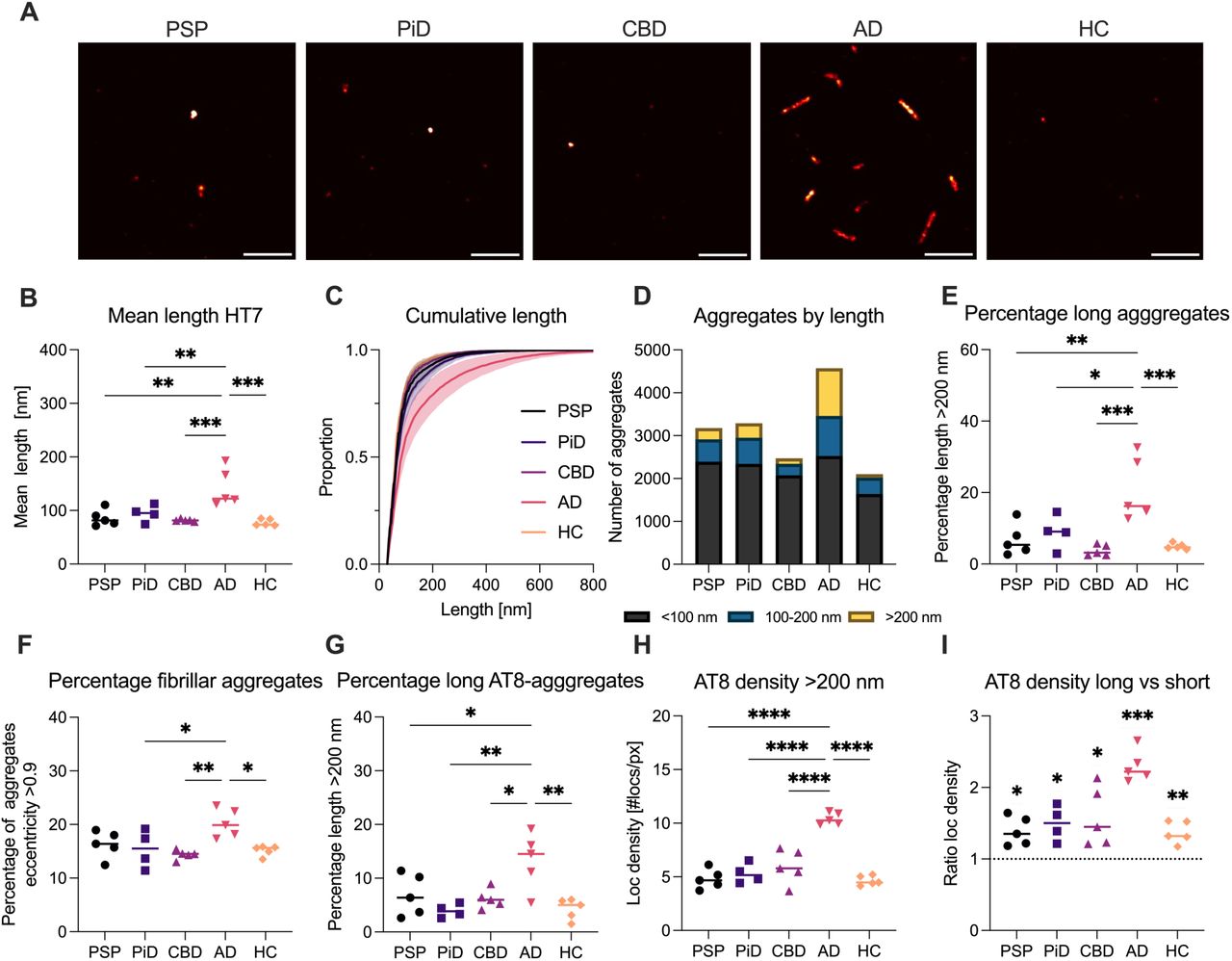 Super-resolution imaging reveals disease-specific tau aggregate morphologies.(A) Representative single-molecule super-resolution images of small tau aggregates in the brain homogenate fraction captured with HT7 antibodies from brain homogenate. Scale bar, 1 µm. (B) Quantification of mean aggregate length. (C) Cumulative distribution of aggregate length. Shown is mean individual cases for each cohort, shading depicts ± S.D.. (D) Total number of aggregates per group, categorised by length into <100 nm (black), 100–200 nm (blue), and >200 nm (yellow). (E) Proportion of aggregates with length >200 nm, used to define “long” aggregates. (F) Proportion of aggregates with eccentricity >0.9, indicative of a fibrillar morphology. (G) Proportion of AT8-positive aggregates with length >200 nm. (H) Localisation density (localisations per pixel) of AT8-positive aggregates >200 nm in length. (I) Ratio of localisation density in long (>200 nm) versus short (<100 nm) AT8-positive aggregates for each sample. In (B) - (D) and (F) – (I), each data point represents an individual case (n = 4 for PiD, n = 5 per other disease group); horizontal lines indicate group medians. Statistical comparisons were performed using one-way ANOVA with Tukey’s post hoc test, or one-sample t-test in panel (I); *p < 0.05, **p < 0.01, ***p < 0.001, ****p < 0.0001. For (E), the mean of the n = 5 cases was used (n = 4 for PiD).