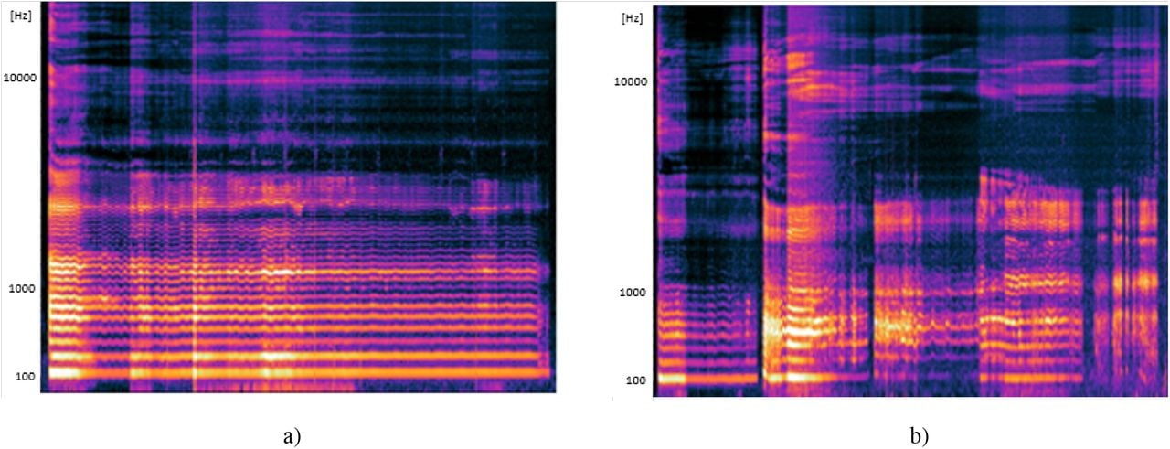 Spectrograms of sustained vowel phonation of participants matched by age and gender (male, age 67) with a) normal RQoL (VQ11 score: 21); and b) impaired RQoL (VQ11 score: 46). Normal RQoL spectrogram is represented by uninterrupted phonation, with clearly distinctive harmonics. Impaired RQoL spectrogram is characterized by strangled voice with multiple stoppages and voice breaks, and increased energy areas in higher frequency bands. The absence of higher harmonics above 1kHz can be observed, and as phonation progresses, the adjacent lower harmonics become smeared and more difficult to distinguish.