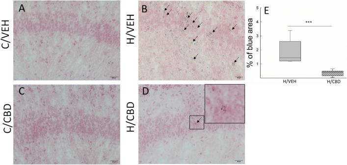 Effects of hypoxia and CBD treatment on free iron accumulation. Representative images of iron staining in the hippocampus area of the (A) control vehicle group (C/VEH); (B) hypoxic vehicle group (H/VEH); (C) control CBD group (C/CBD) and (D) hypoxic CBD group (H/CBD). No iron-positive cells were observed in the brain sections of both control groups (panels (A) and (C)). Iron deposition was the most obvious in the hypoxic vehicle group (panel (B)). A small amount of iron deposits has been observed in the hypoxic CBD group (panel (D)). Scale bars: 50 μm; staining is denoted by the arrows. Panel (E)—A quantitative evaluation using Fiji software shows the percentage of blue spots in hypoxic groups (***p ≤ 0.001). Box indicates 25th and 75th percentiles, solid line stands for the median in each experimental group.