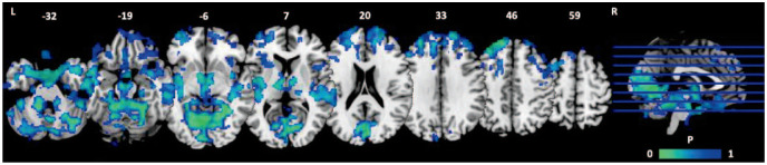 Drug effects on the fractional amplitude of low-frequency fluctuations across the grey matter (cannabidiol > placebo). Numbers above the slices indicate location in z-direction (in millimetres). Scans are oriented in neurological convention, where right (R) equals right, and left (L) equals left. P values (P), as indicated by the colour bar, are corrected for multiple comparisons (TFCE, FWE).