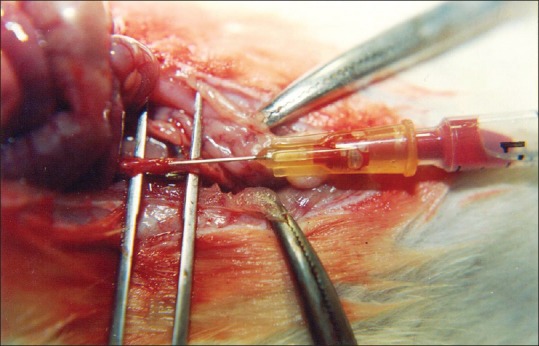 Blood sample collected from the abdominal aorta