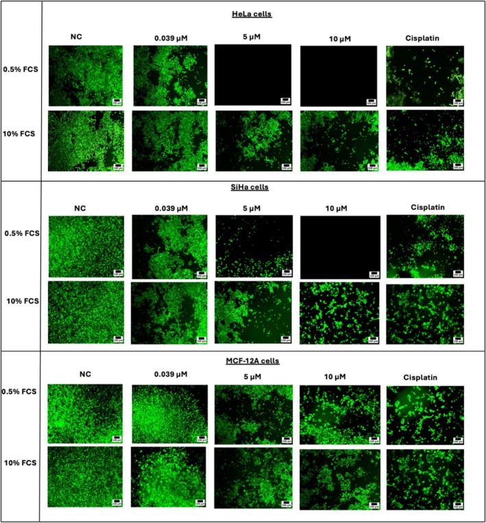 Fluorescence microscopy images of HeLa, SiHa, and MCF‐12A cells treated with CBD for 72 h. Images were captured at ×100 magnification. Scale bar = 100 μm. NC = negative control. Cisplatin (30 μM) was used as a positive control.