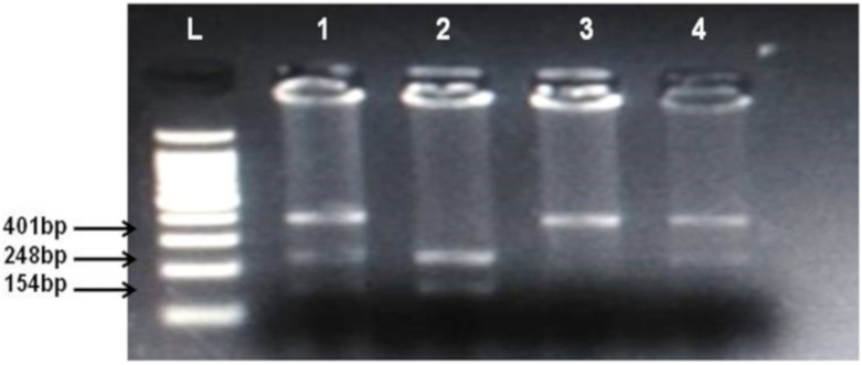 Identification of cannabinoid receptor 1 (CNR1) rs806368 polymorphism. Lanes L, DNA ladder, 1 and 4 show CT heterozygotes (Cleaved PCR product 248 bp, 154 bp and uncleaved PCR product 401 bp), 2 CC homozygote (cleaved PCR product into 248 bp and 154 bp fragments), 3 TT homozygote (uncleaved PCR product 401 bp).