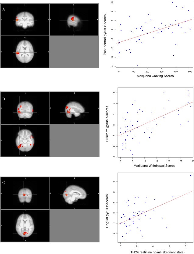 Correlations between cannabis cue (vs. fruit cue) and Marijuana Craving Questionnaire (MCQ), Marijuana Withdrawal Checklist (MWC), creatinine‐weighted THC ng/ml in cannabis users. Crosshairs depict the peaks in users for the correlation with (A) right post‐central gyrus and MCQ scores (B) right fusiform gyrus and MWC scores, (C) right lingual gyrus and THC levels (over creatinine). The scatterplots show the relationship of Gaussianized t‐scores at the peak with each behavioral measure (cluster‐threshold z = 2.3, FWE P < 0.05).