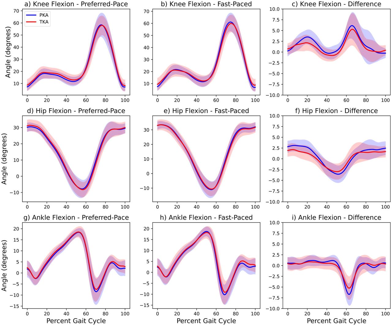Ensemble waveforms with standard deviation shading for knee, hip, and ankle flexion angles during walking trials for PKA (blue) and TKA (red) patients on the surgical side. Sub-figures a), d), and g) show preferred-pace trials; b), e), and h) show fast-paced trials; and c), f), and i) show the computed difference between fast- and preferred-pace trials. Note: Difference waveforms (c, f, i) are plotted on a smaller y-axis scale to reflect the lower magnitude of change between conditions.
