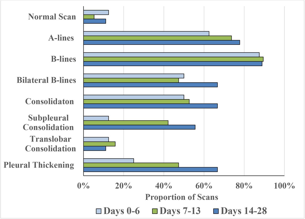 Distribution of Lung Ultrasound Findings by Time. Lung findings were stratified by days from symptom onset to the ultrasound scan in the following manner: early (0-6 days), middle (7-13 days), and late (14-28 days). The portion of scans that contained the above findings are displayed on the horizontal axis.