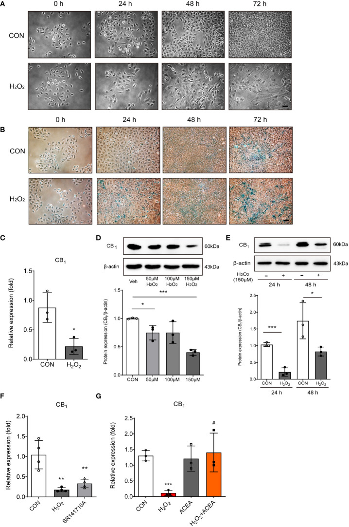 H2O2-induced cell senescence in vitro model induced CB1 reduction. (A) Morphological changes showed IEC-6 cell senescence by H2O2 treatment (150 μM) in a time-dependent manner (n=3). Scale bar, 100 μm. (B) β-gal staining indicated that positive cells (blue) increased with H2O2 treatment (150 μM) in a time-dependent manner (n=5). Scale bar, 100 μm. (C) qPCR was conducted to confirm the RNA expression of CB1 in H2O2-treated IEC-6 cells. Statistical differences were determined using t-test; a single asterisk (*) indicates p<0.05 compared to the control group. Error bars, SD (n=3). GAPDH was used for the loading control. (D, E) Western blot analysis was conducted to investigate the CB1 expression alteration by H2O2 treatment. The bar graphs represent the optical density quantification of the protein bands for each group (D, E, bottom). Statistical differences were determined using t-test; a single asterisk (*) indicates p<0.05, triple asterisks (***) indicate p<0.001 compared to control group. Error bars, SD (n=3). β-actin was used for the loading control. (F, G) CB1 mRNA expression was detected by qPCR in H2O2-treated IEC-6 cells and in cells treated with the selective CB1 inverse agonist, SR141716A (F), and/or the selective CB1 agonist ACEA (G). Statistical differences were determined using t-test; **p<0.01 and ***p<0.001 compared to control group. #p<0.05 compared to H2O2-treated group. Error bars, SD (n=3).