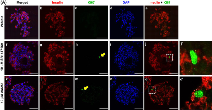Effects of SR141716A and AM251 on human β-cell proliferation. Representative confocal images of paraffin-embedded sections of human islets probed with antibodies directed against insulin (red) and Ki67 (green), and DAPI staining (nuclei; blue) after maintenance of 250 islets in culture for 48 h in the absence or presence of 10 µM SR141716A or AM251 (a). Scale bar = 50 μm. Post-acquisition analyses were performed with Fiji Image J software and are shown in b–d: b number of Ki67- and insulin-positive cells per islet; c mean islet area (μm2) and d number of β-cells (insulin-positive cells) per islet. Data were obtained from multiple acquisitions of 169–210 islets per condition, each with a minimum of eight paraffin sections for analysis from three human donors. ***P < 0.001 and ****P < 0.0001 vs. vehicle. Data were analysed using one-way ANOVA, followed by Dunnett’s multiple comparison post test