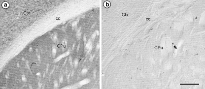 Light micrographs showing immunoperoxidase labeling for the guinea pig anti-CB1R antiserum in a coronal section through the dorsal striatum of a C57/BL6J wild-type (A), but not a CB1R (−/−) mouse. c.c. corpus callosum. Scale bar = 100 μm