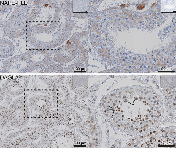 Immunohistochemical expression of the endocannabinoid-synthesising enzymes, NAPE-PLD and DAGLA, in the adult human testis. The images on the left show a general expression pattern, and a higher magnification of an area within a stippled line is shown on the right. All pictures show a low magnification image of negative controls in the right upper corner. NAPE-PLD was present in Leydig and Sertoli cells. DAGLA was present predominantly in the nuclei of germ cells, with only weak reaction detected in Sertoli and Leydig cells. L (leptotene) and P (pachytene) indicate early and late spermatocytes, respectively.