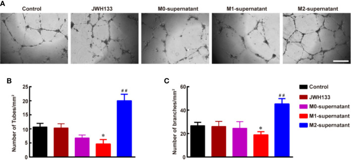 Culture supernatant of M2 microglia induced by JWH133 promotes angiogenesis in vitro in HBMECs. (A) Representative images of tube formation of HBMECs in the Control, JWH133, M1-culture supernatant, and M2-culture supernatant groups. Scale bar: 200 μm. (B, C), Quantitative data of number of tubes (B, per mm2) and branches (C, per mm2) in HBMECs in the Control, JWH133, M1-culture supernatant, and M2-culture supernatant groups. Data are presented as mean ± S.E.M, n = 5; *P < 0.05 and ##P < 0.01 indicate significant differences vs. the Control group (one-way ANOVA followed by Tukey’s post hoc test).