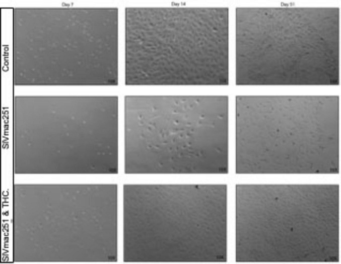 Nine-panel grayscale image showing cell cultures under three conditions: Control, SIVmac251, and SIVmac251 with THC, over days 7, 14, and 21. The Control group shows dense cell growth. SIVmac251 panels depict variable cell loss, while SIVmac251 with THC shows less cell density compared to Control, with variations over time.