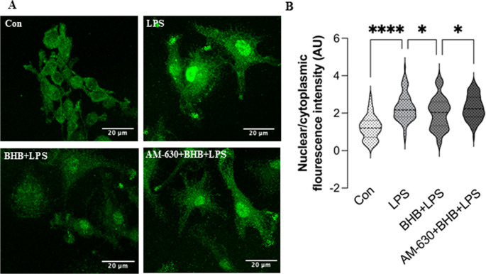 Inhibition of NF-κB nuclear translocation by BHB is partially reversed by CB2R blockade (A) Representative fluorescence images of primary mouse microglia stained with an antibody against NF-κB p65 (green). (B) Violin plot showing the nuclear-to-cytoplasmic intensity ratio of NF-κB p65 across treatment groups. Con – Control group; LPS – LPS-treated group for 24 h (100 ng/mL); BHB + LPS – 1 h pretreatment with BHB before LPS; AM-630 + BHB + LPS – 1 h pretreatment with AM630 (1 µM) before BHB and LPS. n = 90. Data are presented as mean ± SEM. **p < 0.01; **p < 0.0001