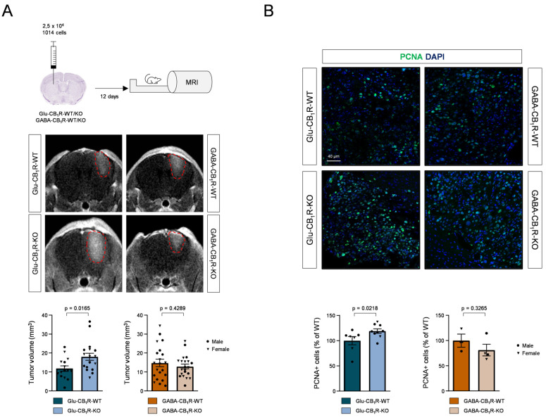 Glutamatergic-neuron CB1Rs influence melanoma cell growth in the brain. (A) Glu-CB1R-KO, GABA-CB1R-KO and control littermates of both sexes were intracranially injected with 25,000 1014 cells in the dorsal striatum, and 12 days later subjected to MRI. Representative images of intracranial tumours and tumour volume quantification are shown. Circles: male mice; triangles: female mice. Comparisons were made by unpaired Student’s t test. (B). Percentage of proliferating, PCNA-immunoreactive cells in tumour brain slices. Representative images are shown on the top, and dot plots showing quantifications relative to total cell nuclei are shown on the bottom. Comparisons were made by unpaired Student’s t test.