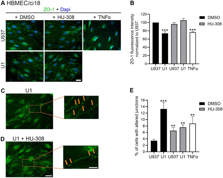 Effect of CB2R agonist HU-308 in ZO-1 expression pattern in BBB systems containing HBMEC/ci18.The tight junction protein ZO-1 was measured on HBMEC/ci18 endothelial cells in multicellular BBB systems. A) ZO-1 expression (green) was detected using immunohistochemistry in cultures exposed to U1 conditioned media for 24 h to control U937-conditioned medium or U1 latent HIV-conditioned medium, in presence of 0.1 % DMSO, 10 μM HU-308 or 10 ng/ml of TNFα. Dapi nuclear staining is shown in blue. Scale bar = 10 μm. B) Quantification of ZO-1 fluorescence intensity measured in ImageJ/Fiji (NIH), normalized by area and to U937 control conditioned medium. Data are expressed as mean of 3 independent experiments in triplicate ± SEM.**p<0.01, ***p<0.001 compared to U937 untreated controls. C, D) Magnification of representative images of HBMEC/ci18 membrane incubated with U1-conditioned media C) in the presence of DMSO control or D) in the presence of 1uM HU-308, allowing the observation of gaps in the expression of the tight junction protein (orange arrows). Scale bar, 5 μm. E) The number of cells showing membrane gaps on ZO-1 distribution was counted in each condition, following exposure to U937 or U1 conditioned media, following pretreatment with 10 uM HU-308 or the vehicle DMSO. TNFa was used as a positive control. **p<0.01, ***p<0.001 for indicated comparisons.