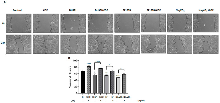 Podocyte cell migration. (A) Representative pictures show the migration of podocyte cells after induction of a scratch representing a wound. All the pictures were taken immediately after the scratch was induced (at zero hours) and 24 h after incision. Podocytes in the pictures were cultured in different conditions, as indicated. Pictures are taken at 10 times magnification. (B) The relative change in cell-free gap surfaces was measured at different time points after the creation of the wounding scratch and is expressed as fold change over zero time. Results are expressed as mean ± SEM of three independent experiments performed in triplicate. Statistical analysis was performed using one-way ANOVA followed by Bonferroni’s multiple comparison test. * p < 0.05; ** p < 0.01; **** p < 0.0001. Scale bar, 100 µM (condition Na3VO4/24 h).