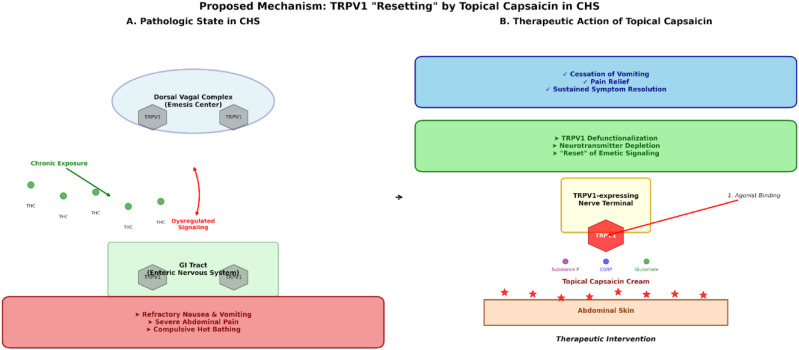 Proposed Mechanism of Topical Capsaicin in CHS. The figure illustrates the hypothesized “TRPV1 Resetting” mechanism: 1. Pathologic State (CHS): Chronic cannabinoid exposure leads to downregulation and/or desensitization of TRPV1 receptors in the gut and CNS, disrupting normal emetic and thermoregulatory pathways. 2. Intervention (Topical Capsaicin): High-concentration topical capsaicin acts as a “super-agonist” on cutaneous TRPV1 receptors. 3. Acute Effect: Initial depolarization of afferent nerves causes burning sensation. 4. Therapeutic Effect: Sustained application leads to defunctionalization of the TRPV1-expressing nociceptive nerve terminals. This involves depletion of substance P, CGRP, and other neurotransmitters, and temporary inactivation of the nerve terminal. This “resets” the aberrant signaling, mirroring the effect of a prolonged hot shower but in a more potent and sustained pharmacological manner