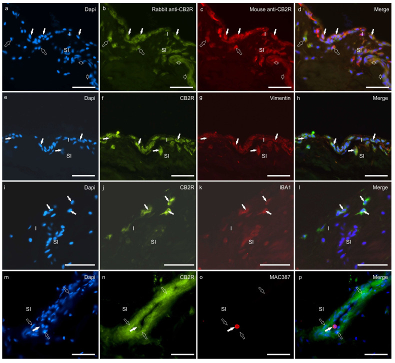 (a–d) Photomicrographs of cryosections of the hip synovial membrane of a dog showing colocalisation between two different antibodies directed against cannabinoid receptor 2 (CB2R). The white arrows indicate synoviocytes identified with the mouse anti-CB2R (b) and the rabbit anti-CB2R (c). The open arrows indicate two subintimal cells (likely inflammatory/immune cells) identified with both the anti-CB2R antibodies. The small open arrows indicate a subintimal capillary showing CB2R immunoreactivity. (e–l) Photomicrographs of cryosections of the synovial membrane of the hip (e–h) and stifle (i–l) joints of dogs showing immunoreactivity for the fibroblast marker vimentin (e–h) and the macrophage marker IBA1 (i–l). (e–h). The arrows indicate synoviocytes which showed bright cannabinoid receptor type 2 (CB2R) (f) immunoreactivity and moderate vimentin immunoreactivity (g). (i–l) The arrows indicate three macrophage-like synoviocytes which coexpressed bright CB2R immunoreactivity (j) and moderate IBA1 immunoreactivity (k). (m–p) Photomicrographs of cryosections of the synovial membrane of the stifle joint of a dog showing immunoreactivity for the cannabinoid receptor type 2 (CB2R) (n) and the neutrophils marker MAC387 (o). The open arrows indicate some endothelial cells of a subintimal blood vessel expressing bright CB2R immunoreactivity. The white arrow indicates one neutrophil inside the blood vessel coexpressing bright MAC387 and moderate CB2R immunoreactivity. Abbreviations: I, intima; SI, subintima. Bar: 50 µm.