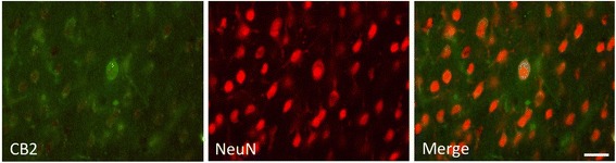 Double-immunostaining for CB2 and NeuN in the contralateral cortex. Some NeuN+ cells were weakly co-labeled with CB2. Scale bar, 25 μm