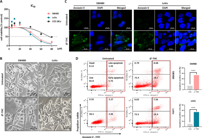 Growth inhibition and cell death effects by Δ9-THC treatment, according to concentration and treatment time. (A) The MTT assay was performed to confirm growth inhibition in SW480 and LoVo colorectal cancer cells by Δ9-THC treatment. Growth inhibition by Δ9-THC treatment was seen in the two colorectal cancer cell lines in dose- and time-dependent manners. The IC50 value was calculated by GraphPad Prism (CCD-18co = 75.15, SW480 = 51.48, and LoVo = 46.97 μM). (B) Cell morphology was dramatically changed by Δ9-THC treatment for 24 h. Numerous vesicles were observed in the cytoplasmic region. (C) Annexin V-FITC fluorescence staining analysis was performed in human colorectal cancer cells treated with Δ9-THC for 24 h. (D) left: Annexin V/FITC/PI flow cytometry analysis was performed to quantify cell death in human colorectal cancer cells treated with Δ9-THC for 24 h. right: Graph showed percentage of apoptotic cells in SW480 and LoVo cells