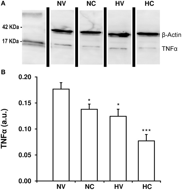 Effect of the treatments on the characteristics of neuroinflammation. (A) A representative image of immunoblotting using anti-TNFα antibody, carried out on the samples from 1- to 2-day-old piglets after hypoxic-ischemic insult, treated with normothermia or hypothermia and administered with either vehicle or cannabidiol. (B) Densitometric analysis of relative TNFα contents. β-actin was used to normalize for the differences in protein loading between lanes in the blot. Bars represent mean ± SEM of 6-8 experiments. (a.u.) arbitrary units; (*) P < 0.05 vs. NV group by Kruskall-Wallis one-factorial analysis of variance; (***) P < 0.05 vs. all groups by Kruskall-Wallis one-factorial analysis of variance.